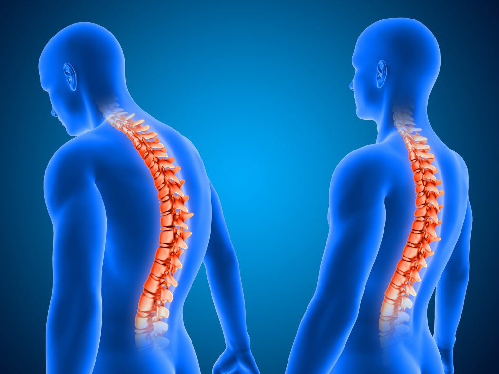 Différentes posture au niveau du dos
